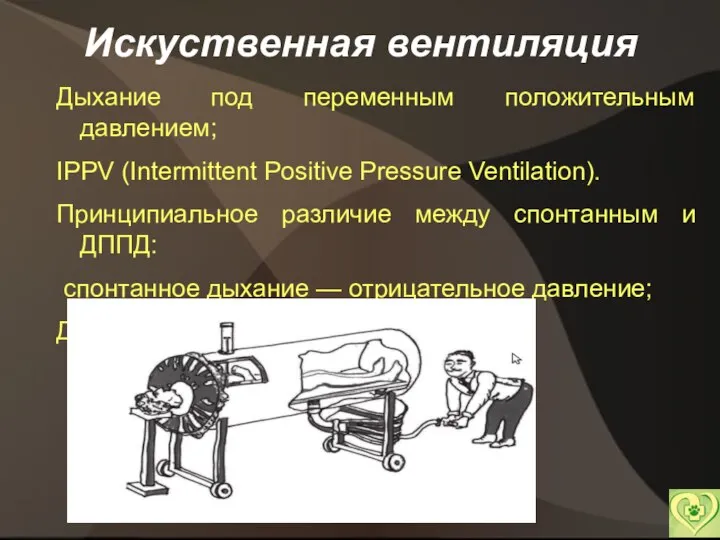 Искуственная вентиляция Дыхание под переменным положительным давлением; IPPV (Intermittent Positive Pressure