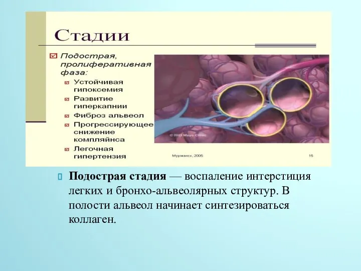 Подострая стадия — воспаление интерстиция легких и бронхо-альвеолярных структур. В полости альвеол начинает синтезироваться коллаген.