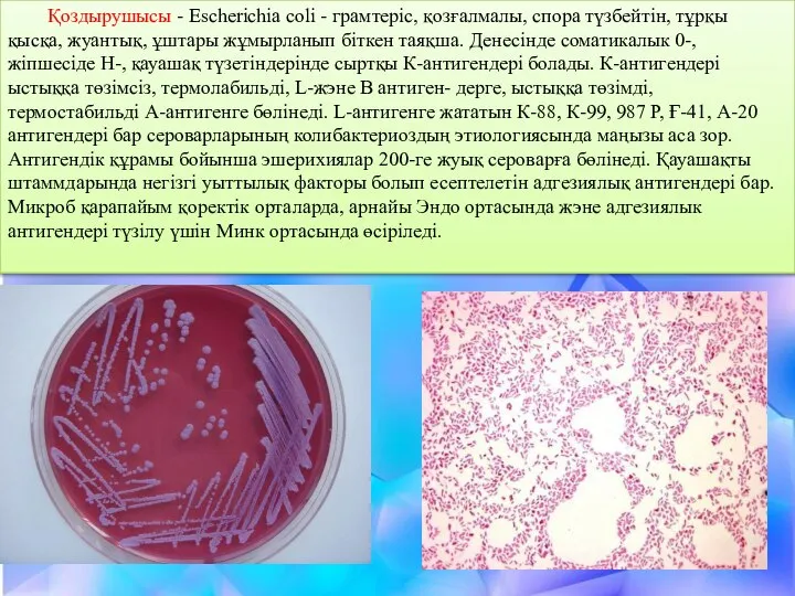 Қоздырушысы - Escherichia соlі - грамтеріс, қозғалмалы, спора түзбейтін, тұрқы қысқа,