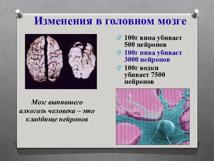 Изменения в головном мозге 100г вина убивает 500 нейронов 100г пива