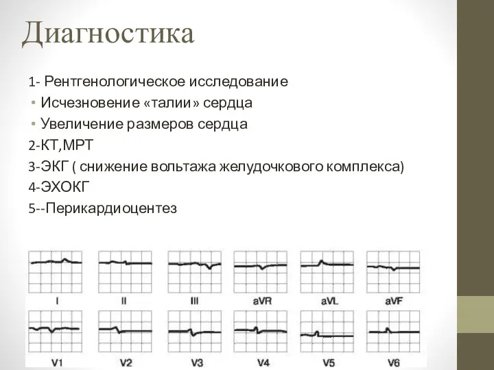 Диагностика 1- Рентгенологическое исследование Исчезновение «талии» сердца Увеличение размеров сердца 2-КТ,МРТ