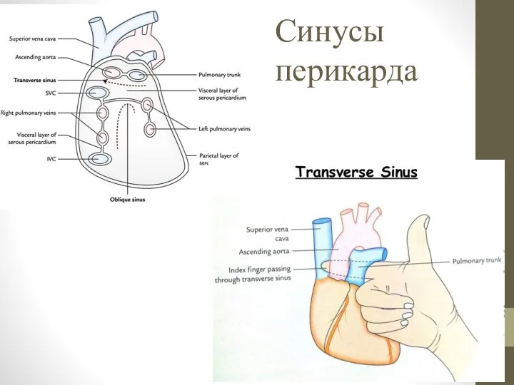 Синусы перикарда