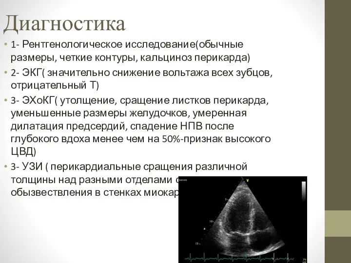 Диагностика 1- Рентгенологическое исследование(обычные размеры, четкие контуры, кальциноз перикарда) 2- ЭКГ(