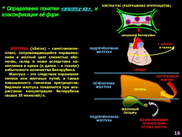 ЖЕЛТУХА (icterus) – симптомоком-плекс, сопровождающийся окрашива-нием в желтый цвет слизистых обо-лочек,