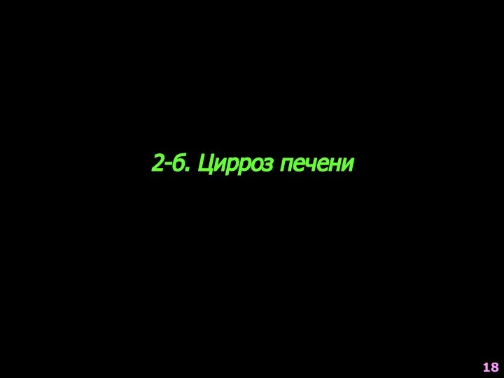 2-б. Цирроз печени 18