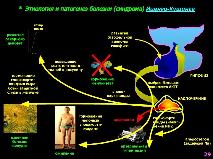 * Этиология и патогенез болезни (синдрома) Иценко-Кушинга развитие базофильной аденомы гипофиза