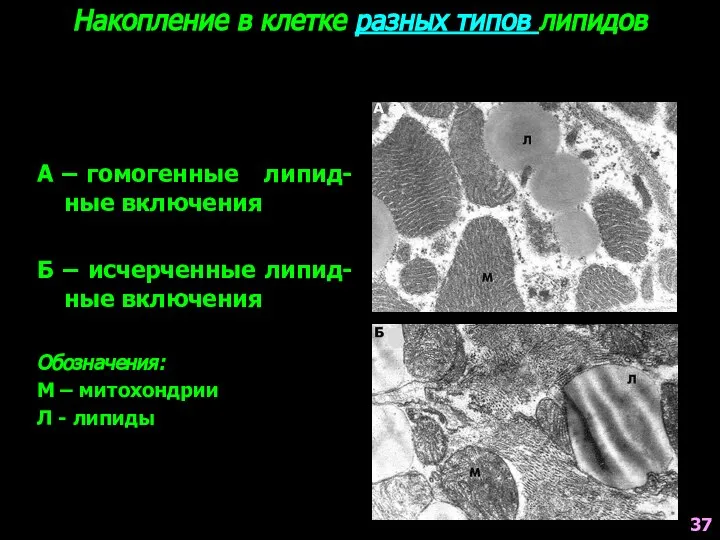 Накопление в клетке разных типов липидов А – гомогенные липид-ные включения