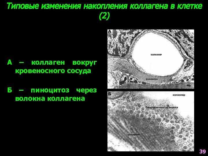 Типовые изменения накопления коллагена в клетке (2) А – коллаген вокруг