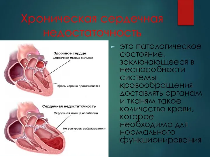 Хроническая сердечная недостаточность это патологическое состояние, заключающееся в неспособности системы кровообращения