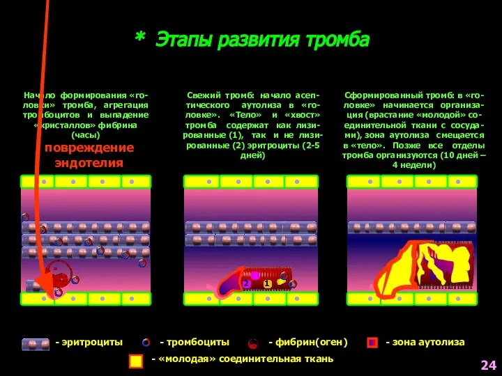 * Этапы развития тромба - эритроциты - тромбоциты - фибрин(оген) Начало