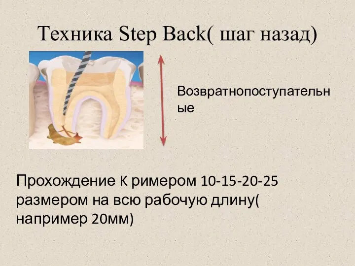 Техника Step Back( шаг назад) Прохождение K римером 10-15-20-25 размером на