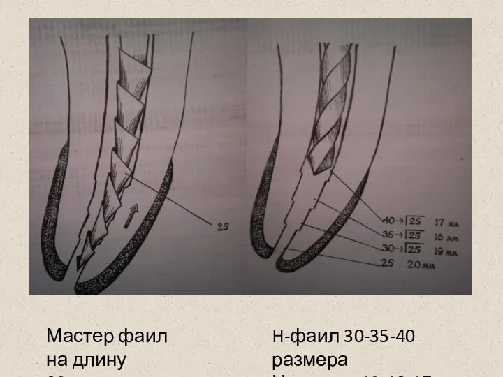 Мастер фаил на длину 20мм H-фаил 30-35-40 размера На длину 19-18-17мм
