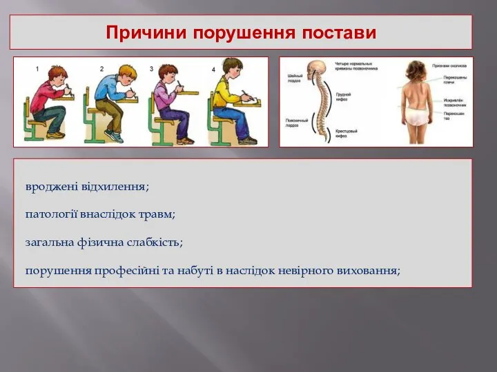 Причини порушення постави вроджені відхилення; патології внаслідок травм; загальна фізична слабкість;