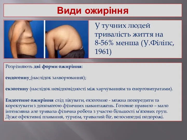 Види ожиріння У тучних людей тривалість життя на 8-56% менша (У.Філіпс,