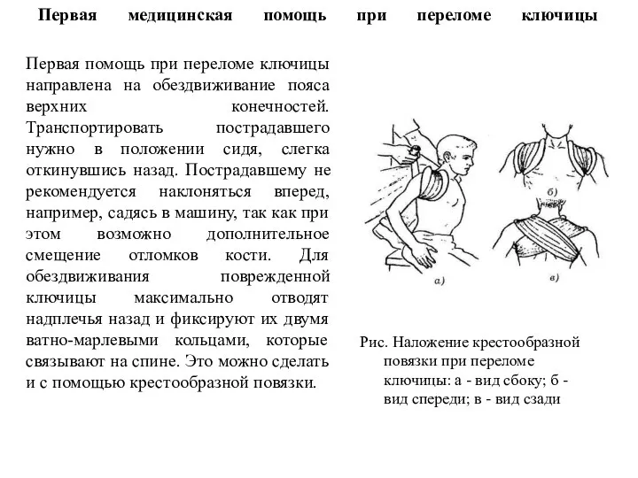 Первая медицинская помощь при переломе ключицы Первая помощь при переломе ключицы