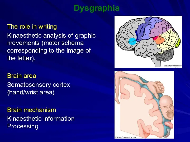 Dysgraphia The role in writing Kinaesthetic analysis of graphic movements (motor