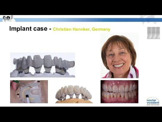 Implant case - Christian Hannker, Germany