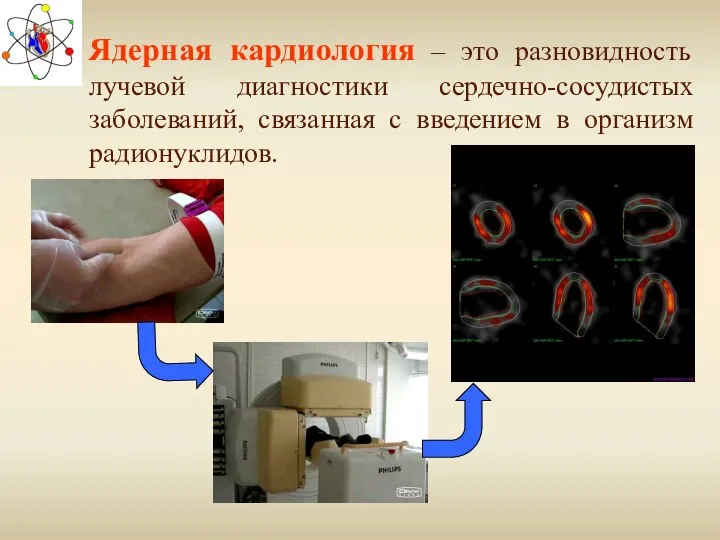 Ядерная кардиология – это разновидность лучевой диагностики сердечно-сосудистых заболеваний, связанная с введением в организм радионуклидов.