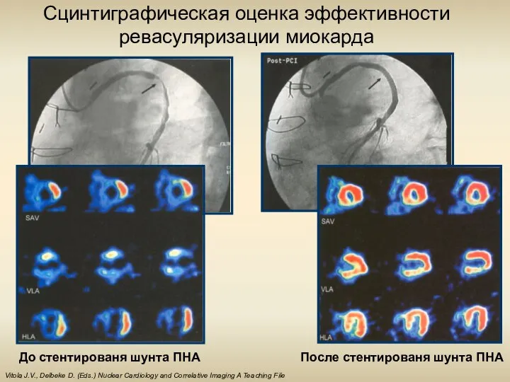 Vitola J.V., Delbeke D. (Eds.) Nuclear Cardiology and Correlative Imaging A