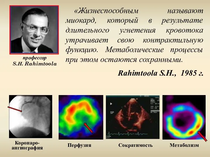 Коронаро- ангиография Метаболизм Перфузия Сократимость «Жизнеспособным называют миокард, который в результате