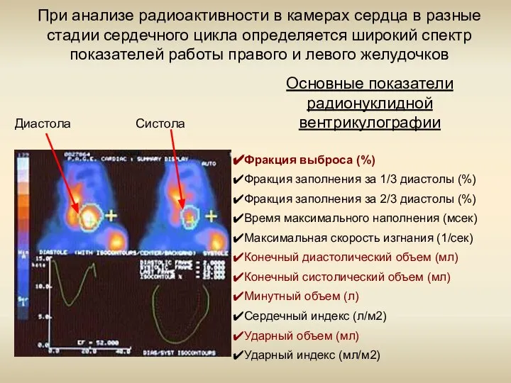 Диастола Систола При анализе радиоактивности в камерах сердца в разные стадии