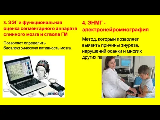 3. ЭЭГ и функциональная оценка сегментарного аппарата спинного мозга и ствола