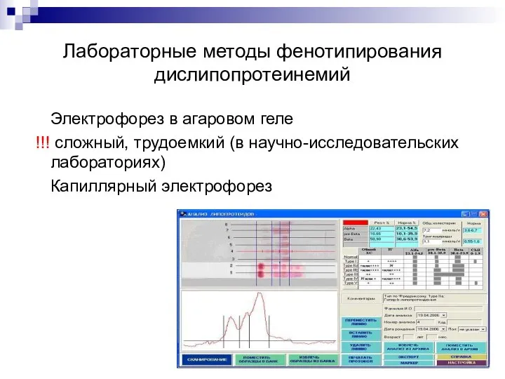 Лабораторные методы фенотипирования дислипопротеинемий Электрофорез в агаровом геле !!! сложный, трудоемкий (в научно-исследовательских лабораториях) Капиллярный электрофорез