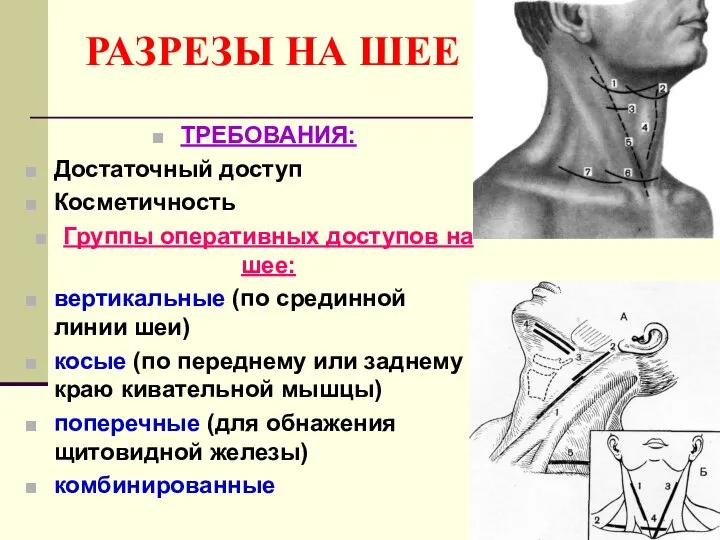 РАЗРЕЗЫ НА ШЕЕ ТРЕБОВАНИЯ: Достаточный доступ Косметичность Группы оперативных доступов на