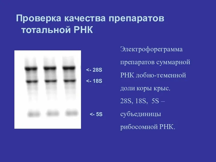 Проверка качества препаратов тотальной РНК Электрофореграмма препаратов суммарной РНК лобно-теменной доли