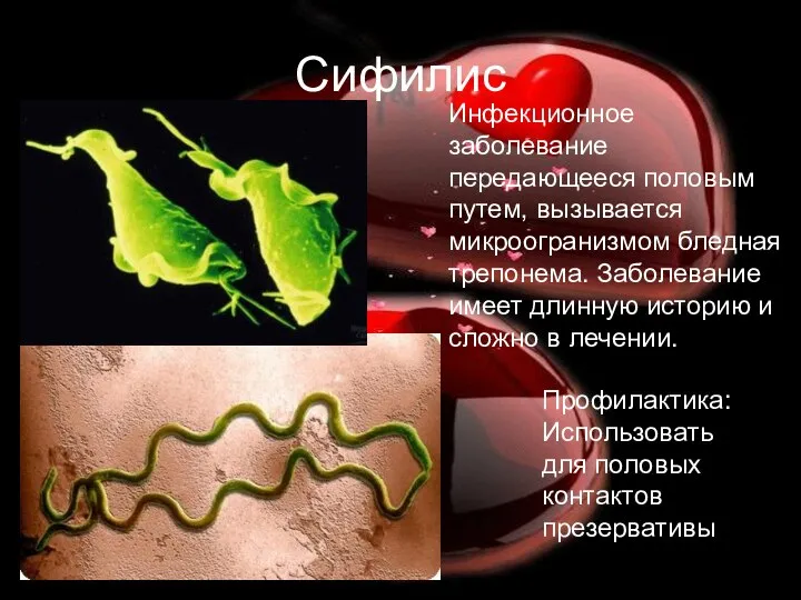 Сифилис Инфекционное заболевание передающееся половым путем, вызывается микроогранизмом бледная трепонема. Заболевание