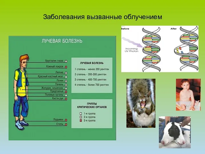 Заболевания вызванные облучением