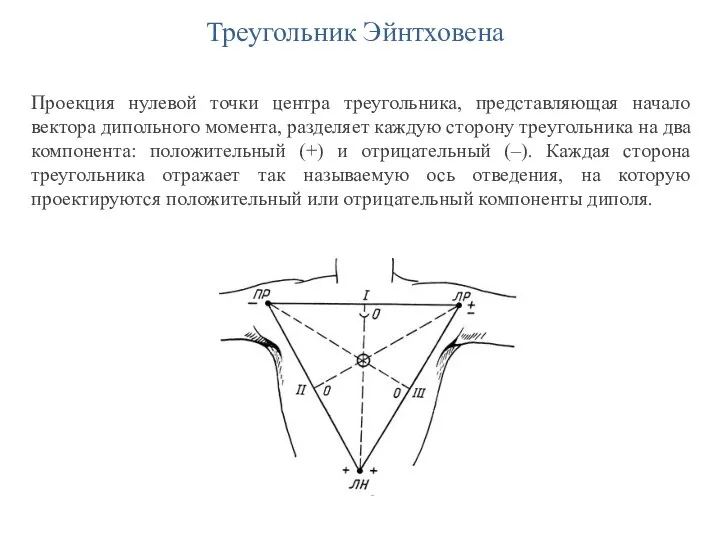 Треугольник Эйнтховена Проекция нулевой точки центра треугольника, представляющая начало вектора дипольного