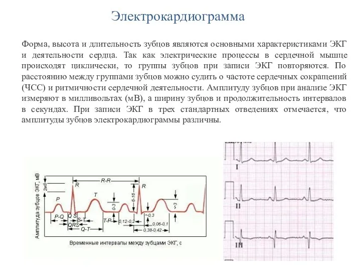 Электрокардиограмма Форма, высота и длительность зубцов являются основными характеристиками ЭКГ и