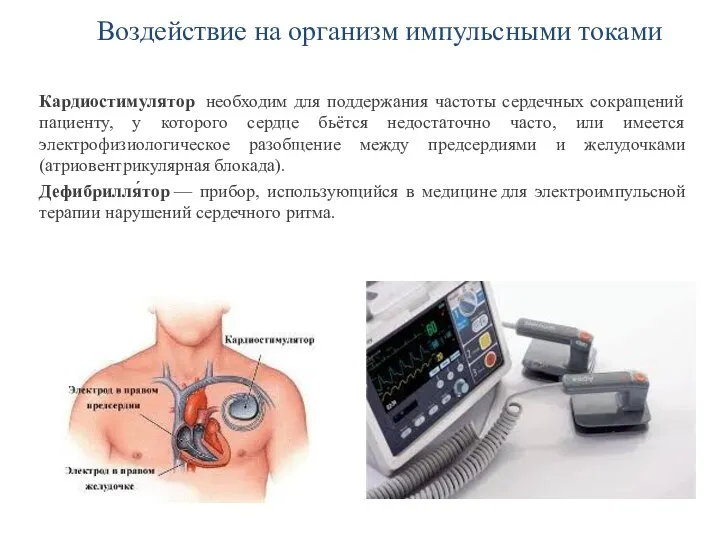 Воздействие на организм импульсными токами Кардиостимулятор необходим для поддержания частоты сердечных