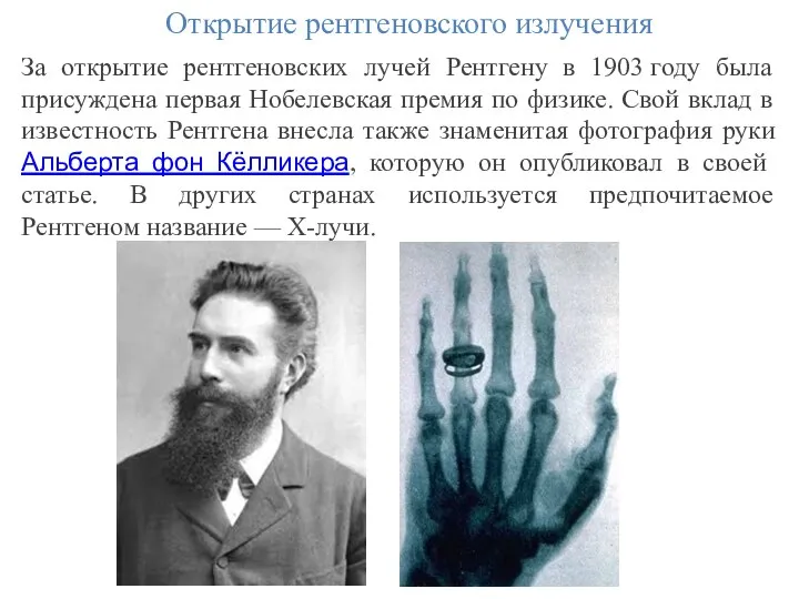 Открытие рентгеновского излучения За открытие рентгеновских лучей Рентгену в 1903 году