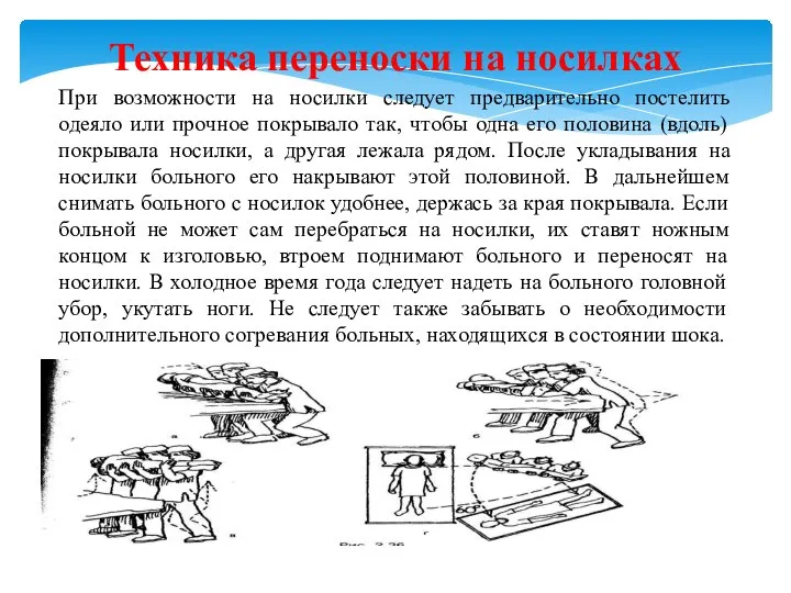 Техника переноски на носилках При возможности на носилки следует предварительно постелить