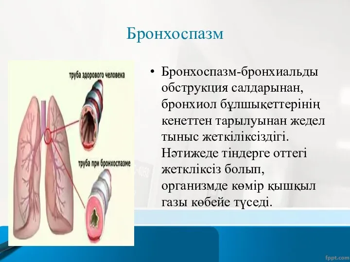 Бронхоспазм Бронхоспазм-бронхиальды обструкция салдарынан,бронхиол бұлшықеттерінің кенеттен тарылуынан жедел тыныс жеткіліксіздігі.Нәтижеде тіндерге