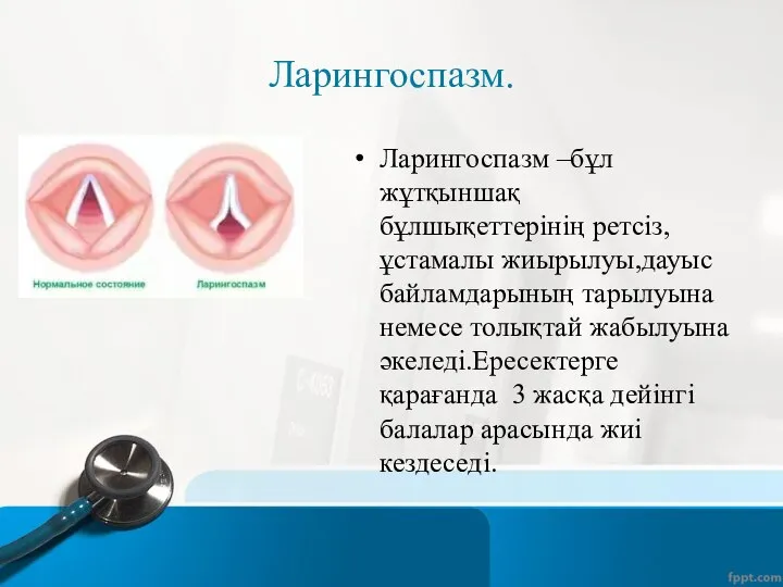 Ларингоспазм. Ларингоспазм –бұл жұтқыншақ бұлшықеттерінің ретсіз,ұстамалы жиырылуы,дауыс байламдарының тарылуына немесе толықтай