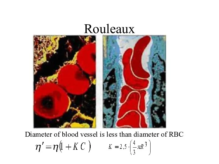 Rouleaux Diameter of blood vessel is less than diameter of RBC