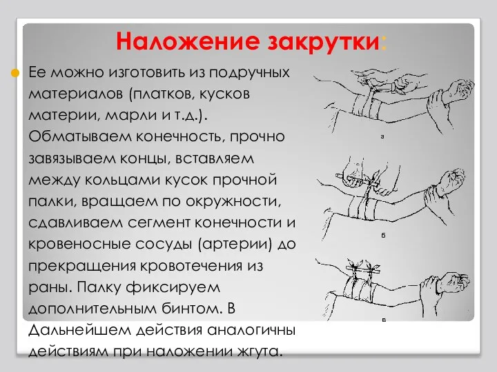 Наложение закрутки: Ее можно изготовить из подручных материалов (платков, кусков материи,