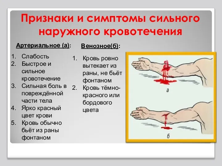 Признаки и симптомы сильного наружного кровотечения Артериальное (а): Слабость Быстрое и