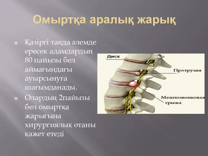 Омыртқа аралық жарық Қазіргі таңда әлемде ересек адамдардың 80 пайызы бел