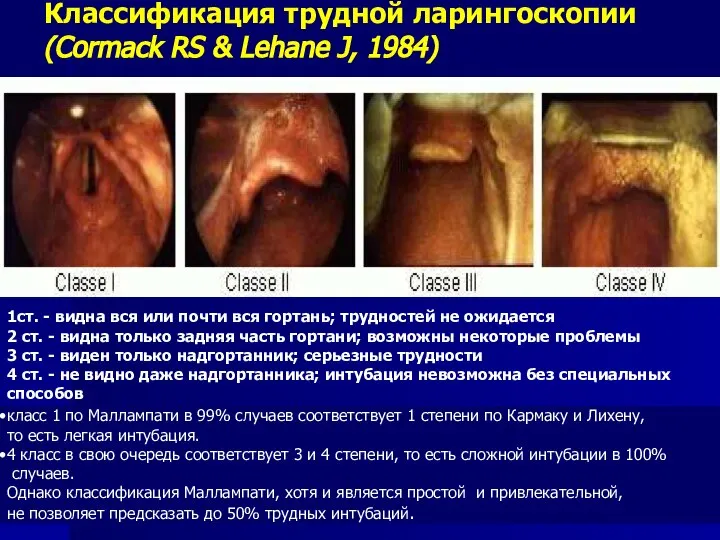 Классификация трудной ларингоскопии (Cormack RS & Lehane J, 1984) 1ст. -