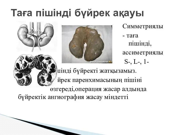 Симметриялы - таға ас пішінді, ассиметриялы S-, L-, 1- пішінді бүйректі