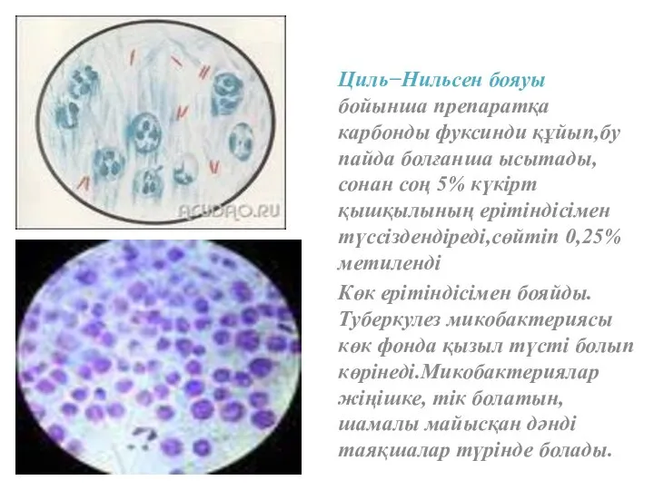 Циль−Нильсен бояуы бойынша препаратқа карбонды фуксинди құйып,бу пайда болғанша ысытады,сонан соң