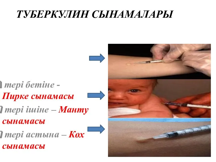 ТУБЕРКУЛИН СЫНАМАЛАРЫ тері бетіне - Пирке сынамасы тері ішіне – Манту