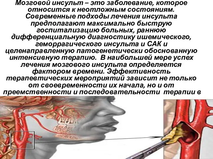 Мозговой инсульт – это заболевание, которое относится к неотложным состояниям. Современные