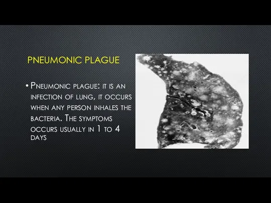 PNEUMONIC PLAGUE Pneumonic plague: it is an infection of lung, it