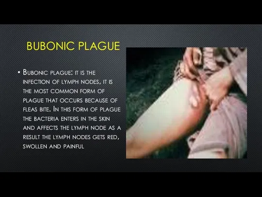 BUBONIC PLAGUE Bubonic plague: it is the infection of lymph nodes,