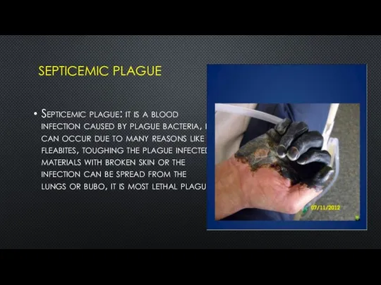 SEPTICEMIC PLAGUE Septicemic plague: it is a blood infection caused by